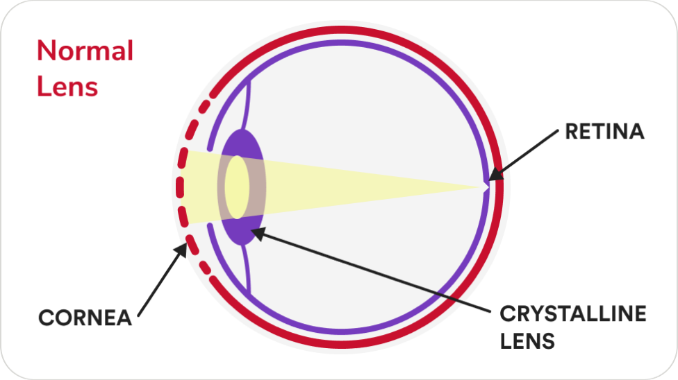 Normal lens